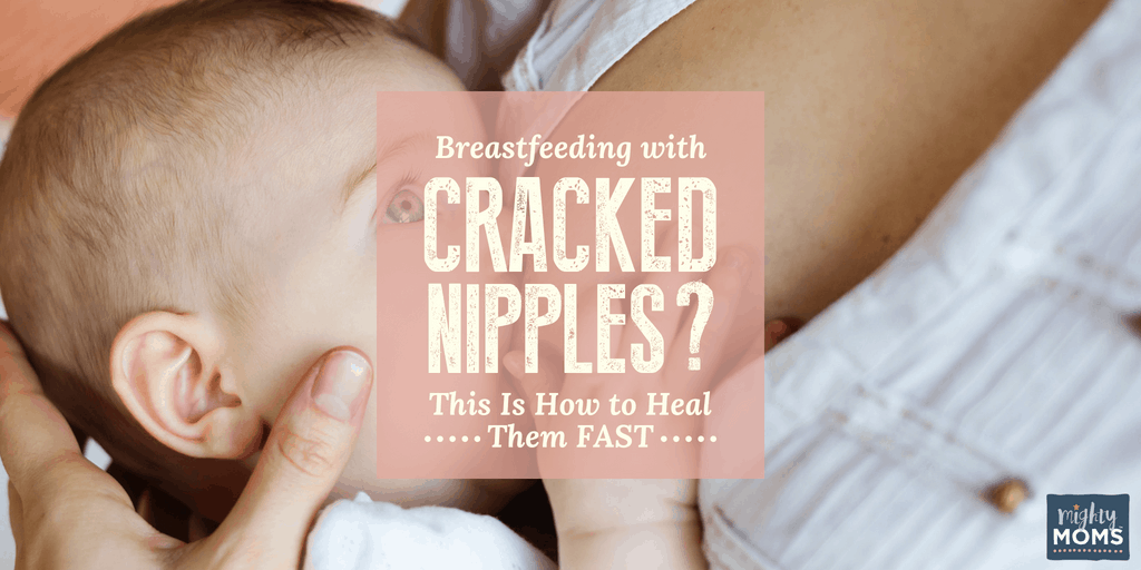 Cracked Nipples BEGONE! - MightyMoms.club