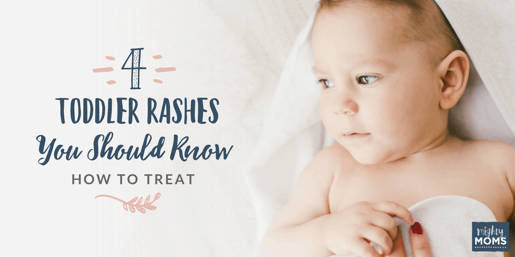 Toddler Rashes to Know About - MightyMoms.club