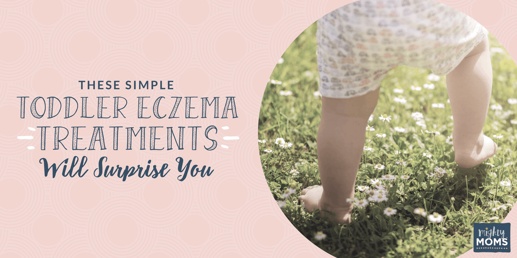 Treating toddler eczema at home - MightyMoms.club